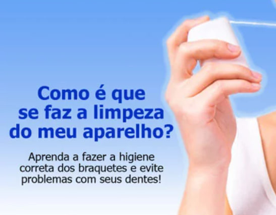 Como fazer a higienização bucal com braquetes (brackets)