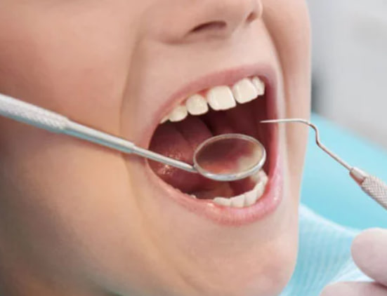 Dúvida: Quando devo ir ao dentista?