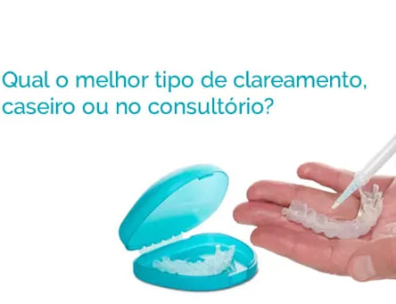 Qual o melhor tipo de clareamento: caseiro ou no consultório?