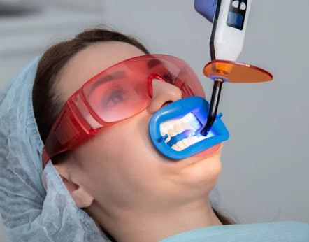 Qual a importância do clareamento dental no consultório?