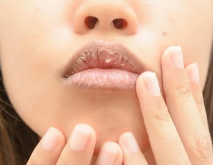 Sensação permanente de boca seca pode indicar doenças