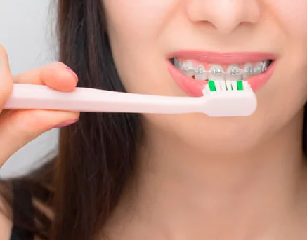 Como fazer a higiene bucal com o aparelho dentário?